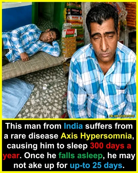 You won't believe this