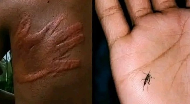 When you dread malaria