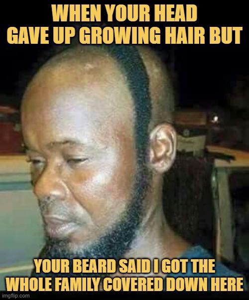 When your head gave up growing hair but. meme