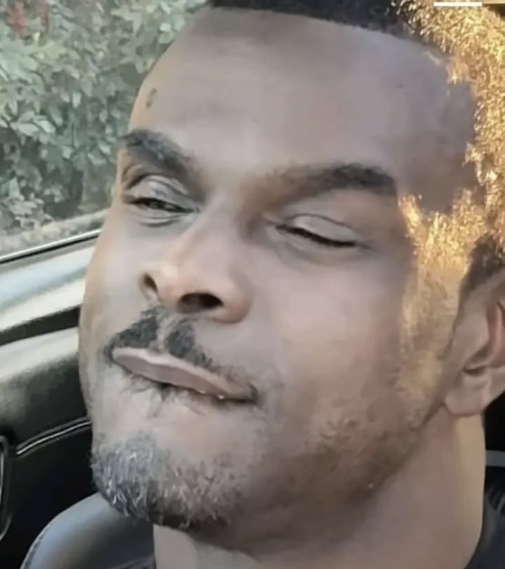 Squinting Sunlit Face